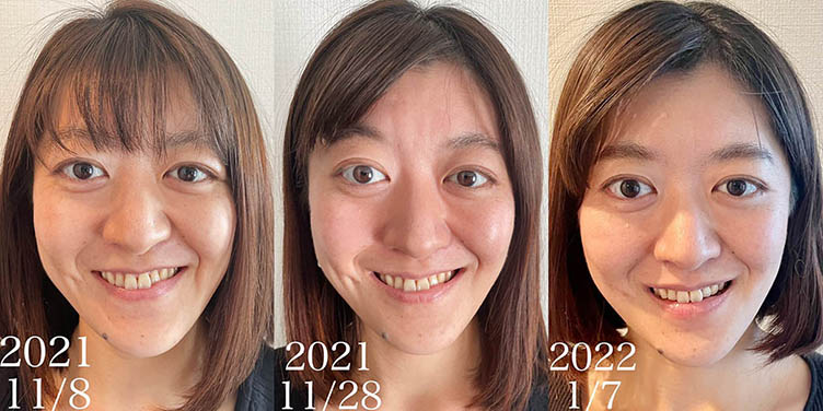 顔のトレーニング変化 コアフェイストレーニング